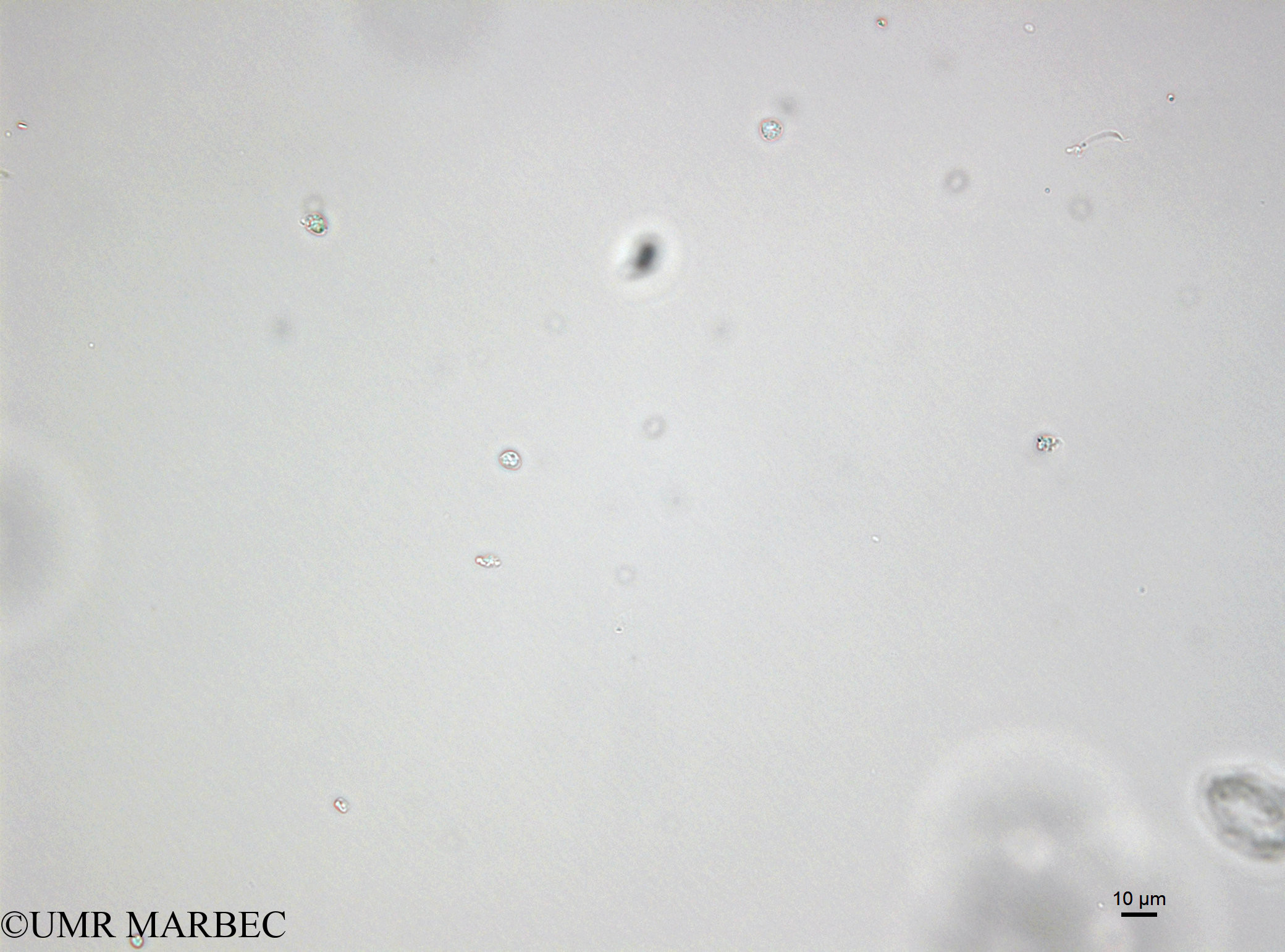 phyto/Bizerte/bizerte_bay/RISCO April 2014/Phaeocystis sp (Microflagellé 17 - Microflagellé spp <10µm -141218_001_ovl -9)(copy).jpg